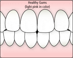 healthy-gums