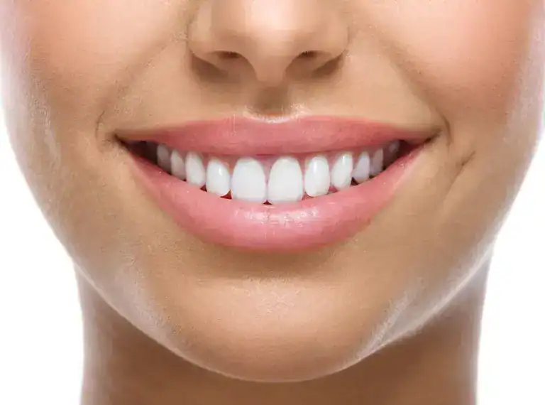 A bright, healthy smile with white teeth and smooth skin.