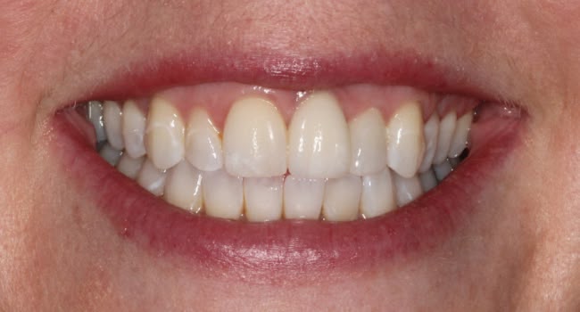 Close-up of a healthy, bright smile with white teeth and pink gums.